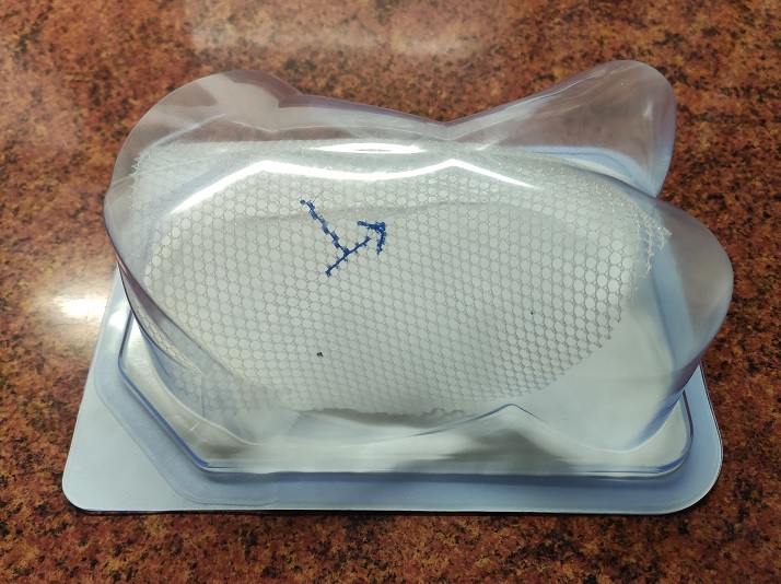 Implant 3D, źródło: Politechnika Krakowska 