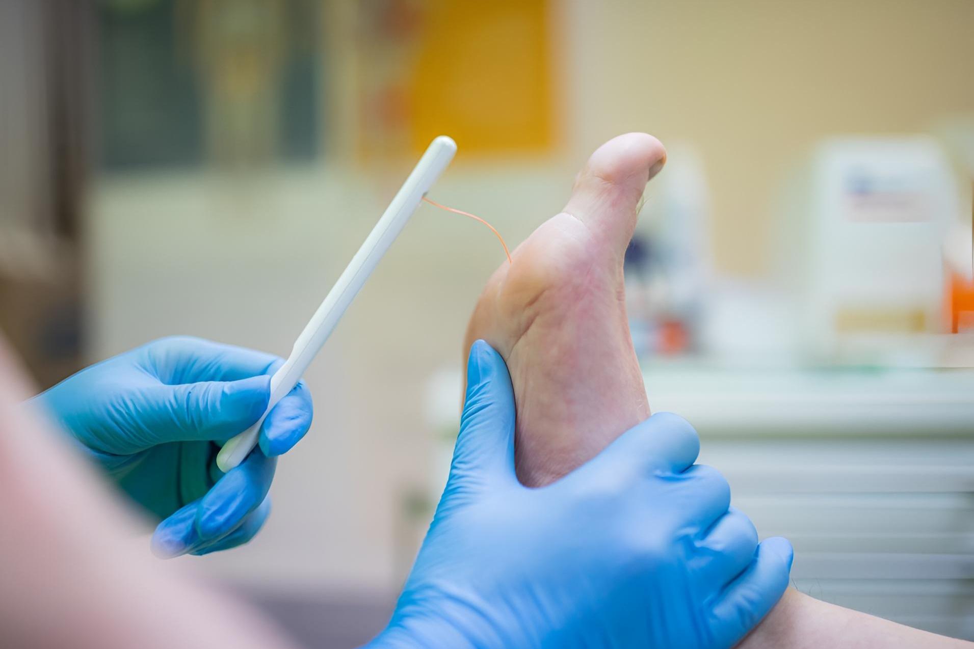 W Tarnowie zbadają cukrzykom stopy, żeby zapobiegać tragediom