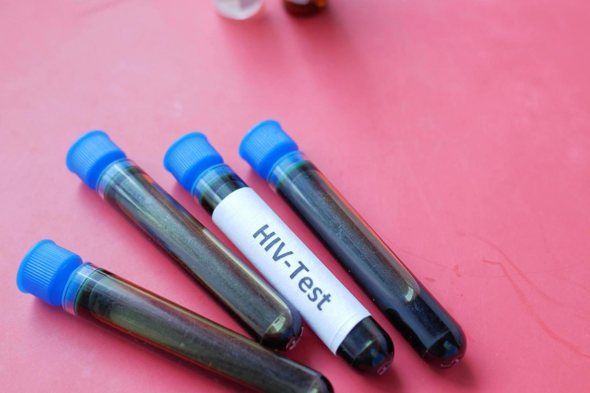 Ekspertka: HIV to nie wyrok - dzięki leczeniu i profilaktyce można prowadzić normalne życie