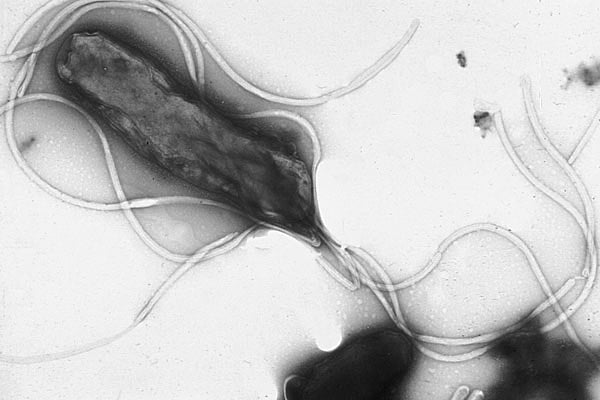 Helicobacter pylori w obrazie z mikroskopu elektronowego (fot. Yutaka Tsutsumi, M.D. Professor Department of Pathology Fujita Health University School of Medicine/Wikipedia) 